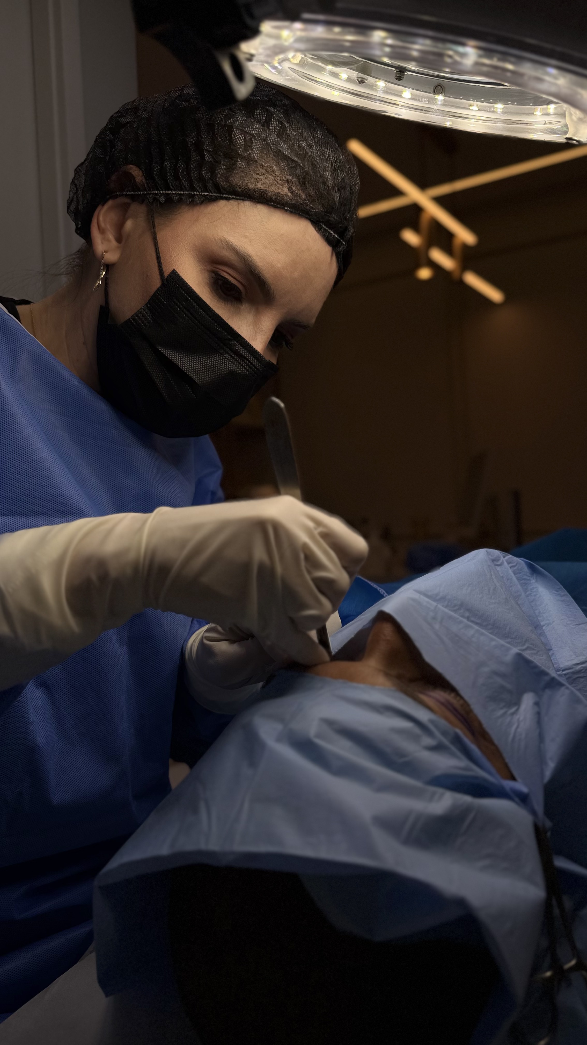 Ilustração do procedimento Blefaroplastia